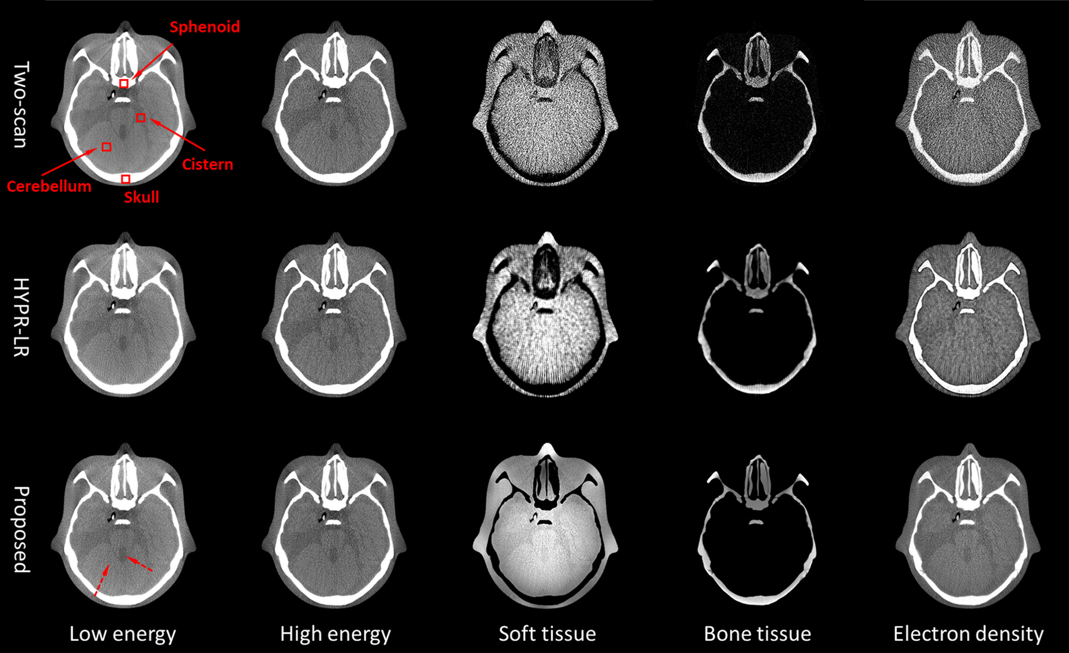 Fast and effective single-scan dual-energy cone-beam CT reconstruction and decomposition denoising based on dual-energy vectorization