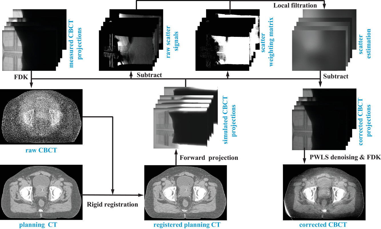 Planning CT-guided robust and fast cone-beam CT scatter correction using a local filtration technique