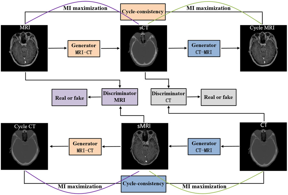 Development of an unsupervised cycle contrastive unpaired translation network for MRI-to-CT synthesis