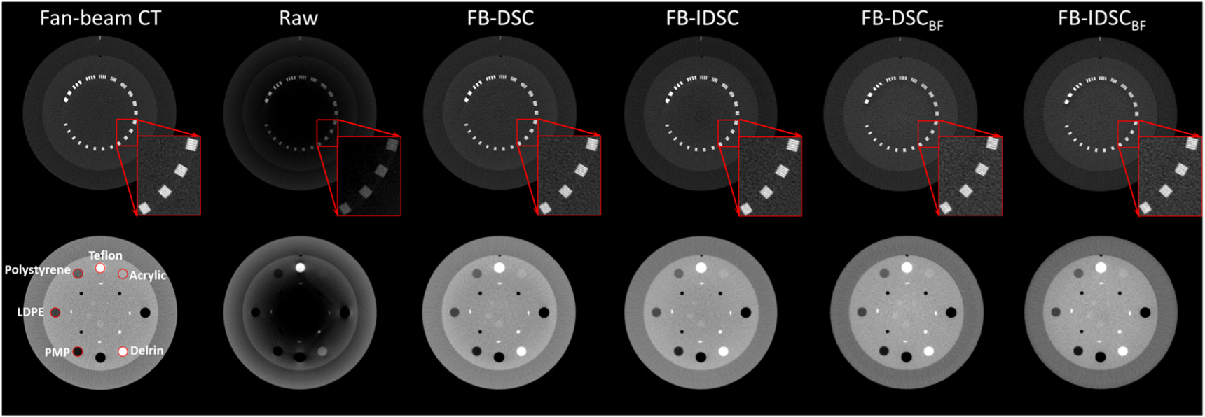 A practical and robust method for beam blocker-based cone beam CT scatter correction