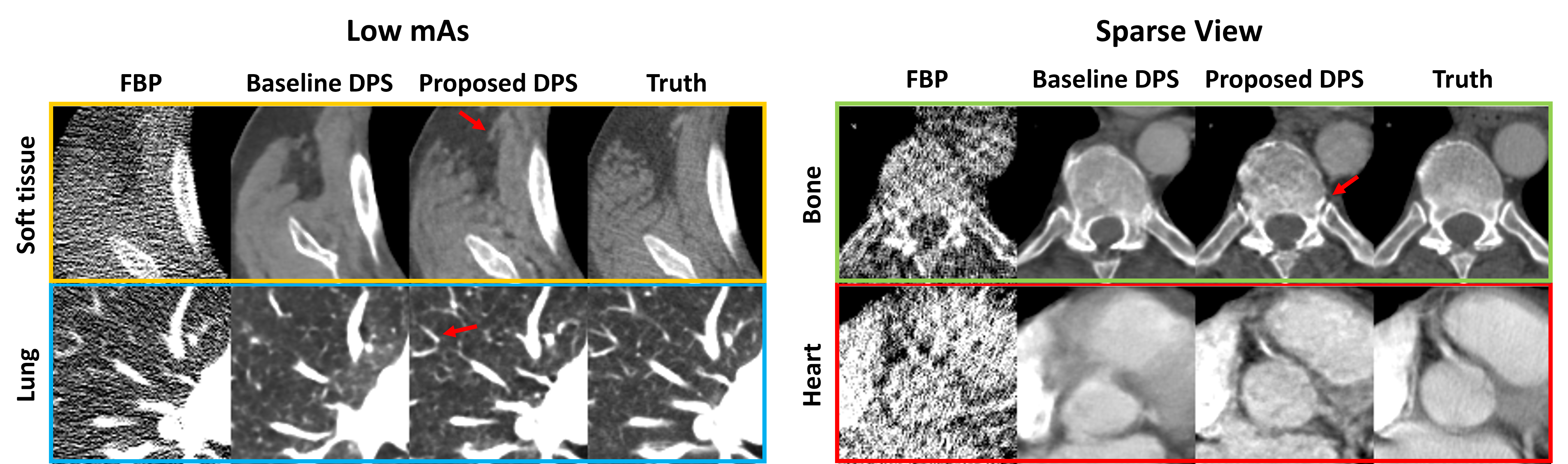 Strategies for CT Reconstruction using Diffusion Posterior Sampling with a Nonlinear Model